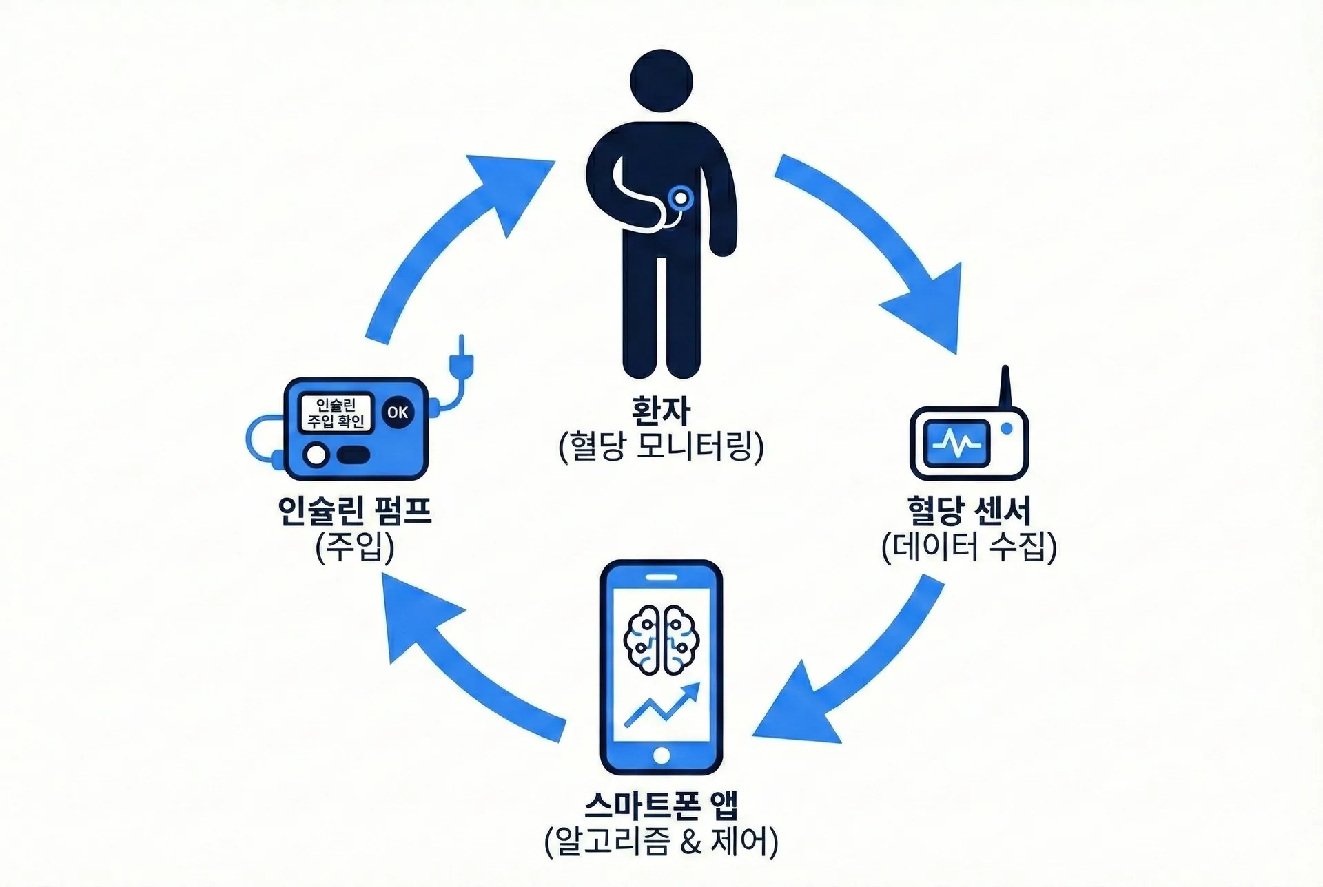 인공췌장 시스템 순환도: 환자, 혈당 센서, 스마트폰 앱(알고리즘), 인슐린 펌프 간의 연결 흐름